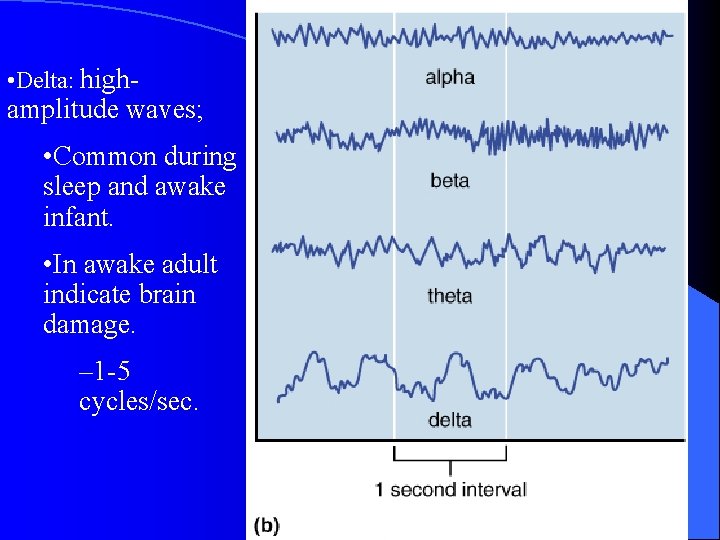  • Delta: high- amplitude waves; • Common during sleep and awake infant. •