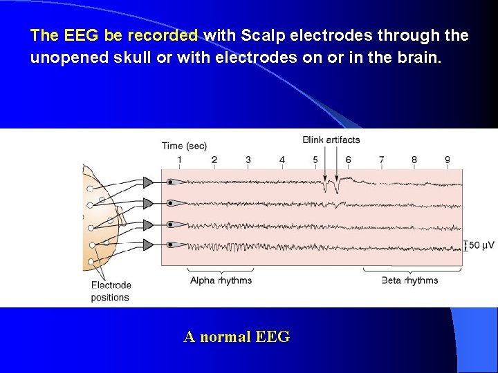 The EEG be recorded with Scalp electrodes through the unopened skull or with electrodes