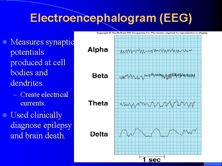 Electroencephalogram (EEG) l Measures synaptic potentials produced at cell bodies and dendrites. – Create