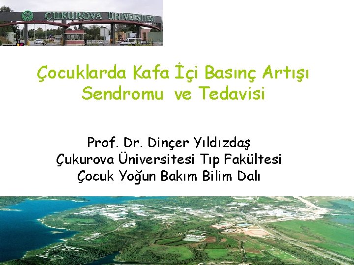 Çocuklarda Kafa İçi Basınç Artışı Sendromu ve Tedavisi Prof. Dr. Dinçer Yıldızdaş Çukurova Üniversitesi