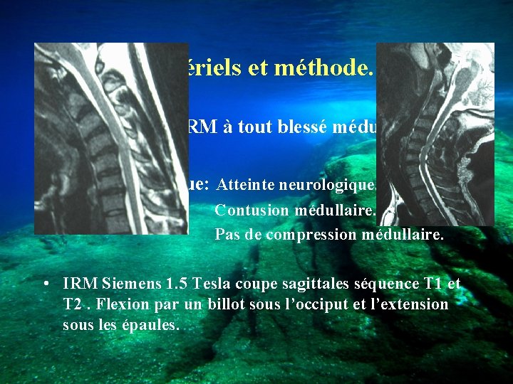Matériels et méthode. • Janvier 2000 IRM à tout blessé médullaire. • IRM dynamique: