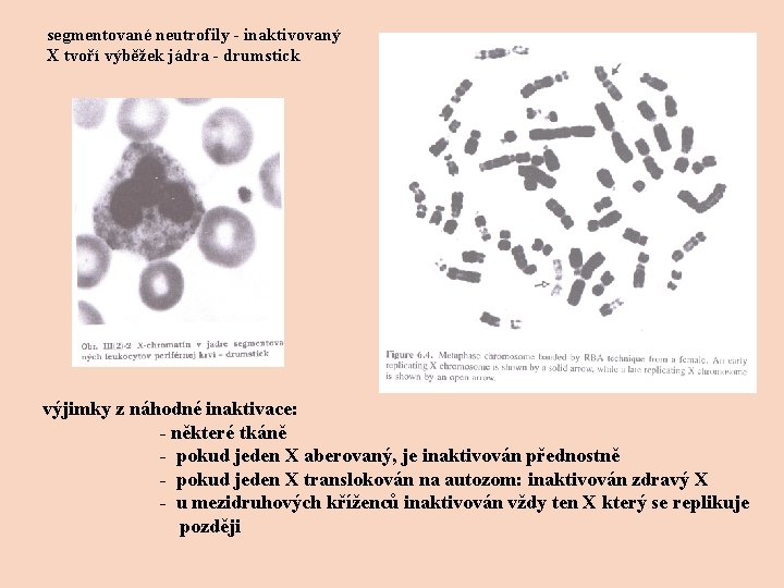 segmentované neutrofily - inaktivovaný X tvoří výběžek jádra - drumstick výjimky z náhodné inaktivace: