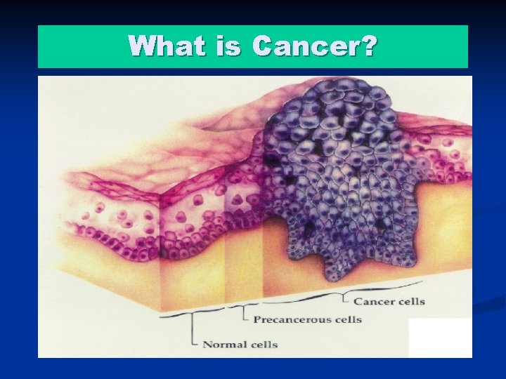 What is Cancer? 