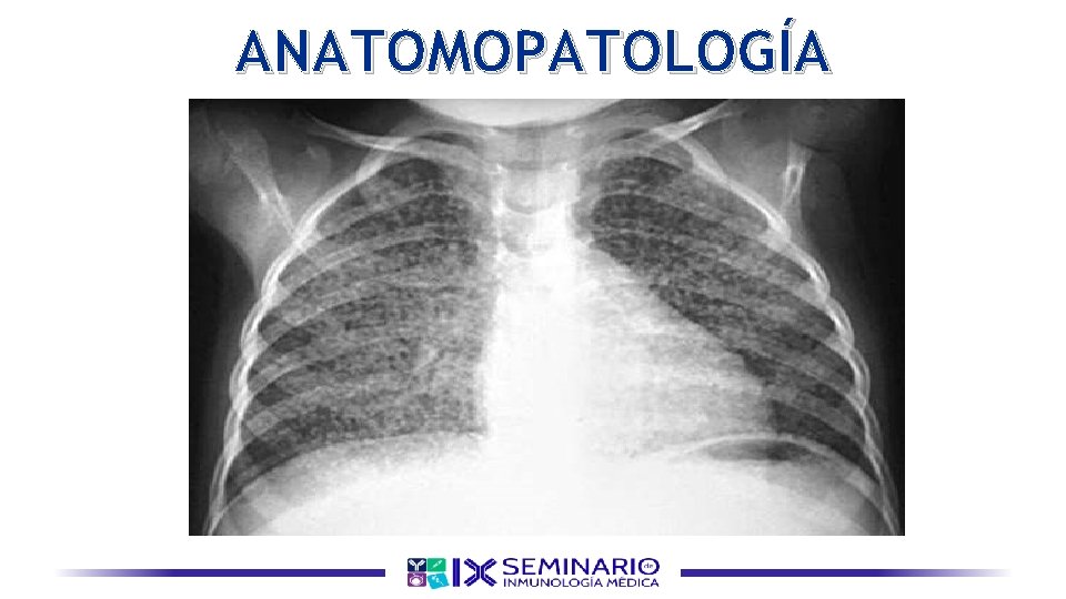 ANATOMOPATOLOGÍA 