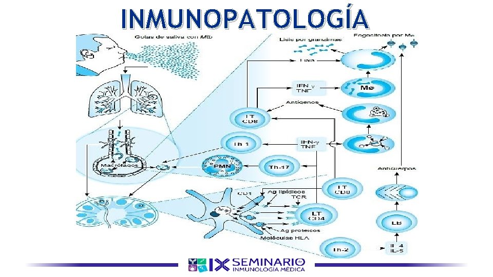 INMUNOPATOLOGÍA 