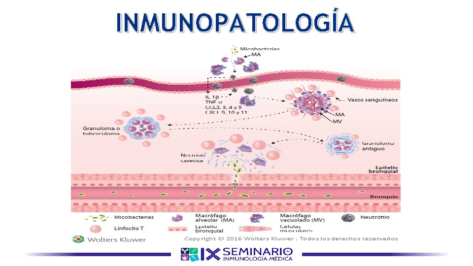 INMUNOPATOLOGÍA 