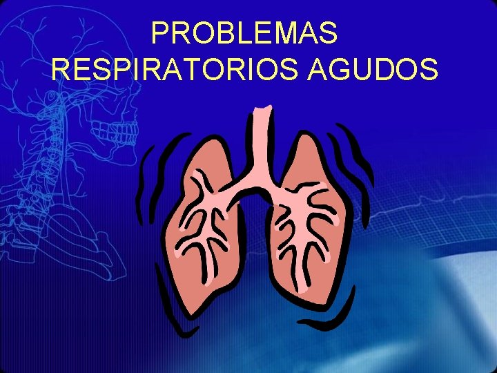 PROBLEMAS RESPIRATORIOS AGUDOS 