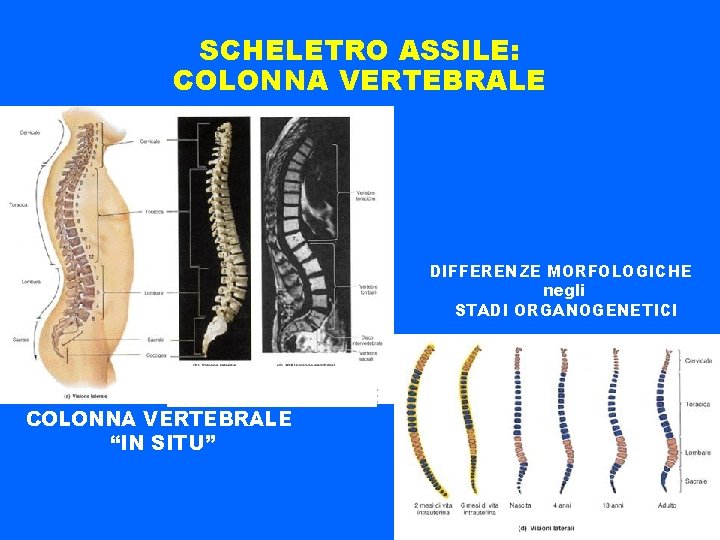 SCHELETRO ASSILE: COLONNA VERTEBRALE DIFFERENZE MORFOLOGICHE negli STADI ORGANOGENETICI COLONNA VERTEBRALE “IN SITU” 