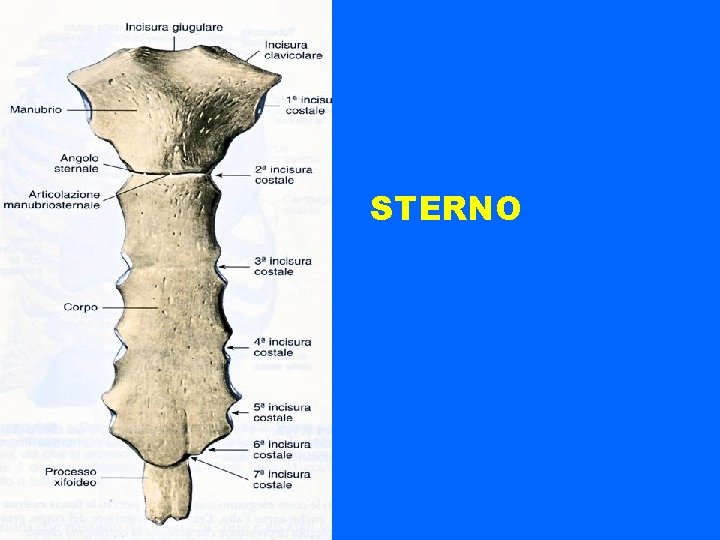 STERNO 