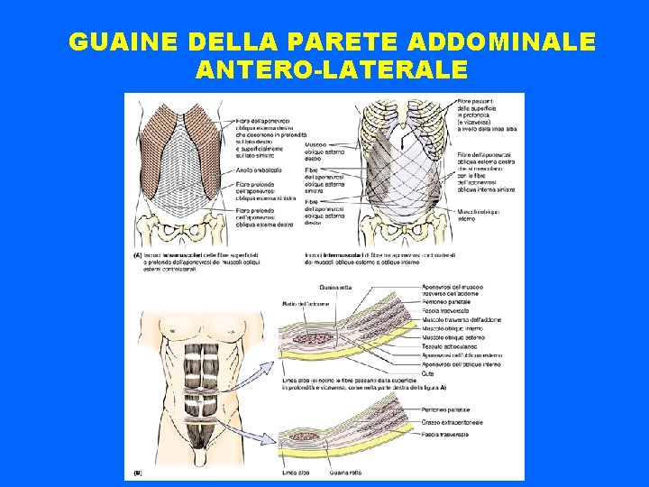 GUAINE DELLA PARETE ADDOMINALE ANTERO-LATERALE 