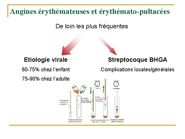 Angines érythémateuses et érythémato-pultacées De loin les plus fréquentes Etiologie virale Streptocoque BHGA 60 Angines érythémateuses et érythémato-pultacées De loin les plus fréquentes Etiologie virale Streptocoque BHGA 60