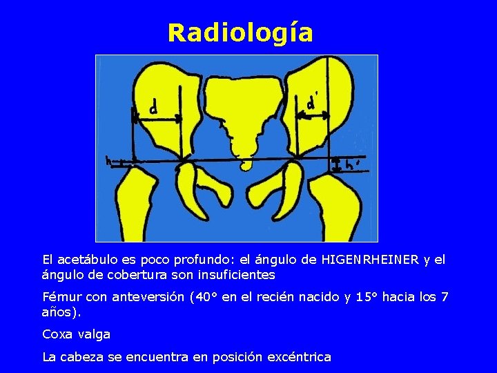 Radiología El acetábulo es poco profundo: el ángulo de HIGENRHEINER y el ángulo de