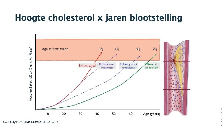 Courtesy Prof. Ernst Rietzschel, UZ Gent ABE. ALI. 17. 12. 0598 Accumulated LDL-C (mg/dl/jaar)