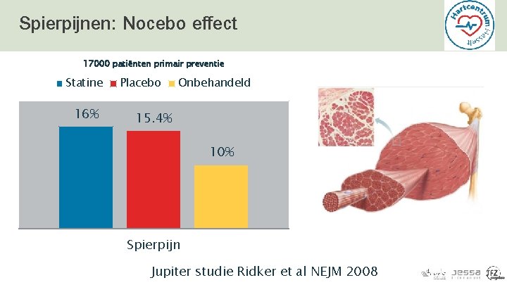 Spierpijnen: Nocebo effect 17000 patiënten primair preventie Statine 16% Placebo Onbehandeld 15. 4% 10%