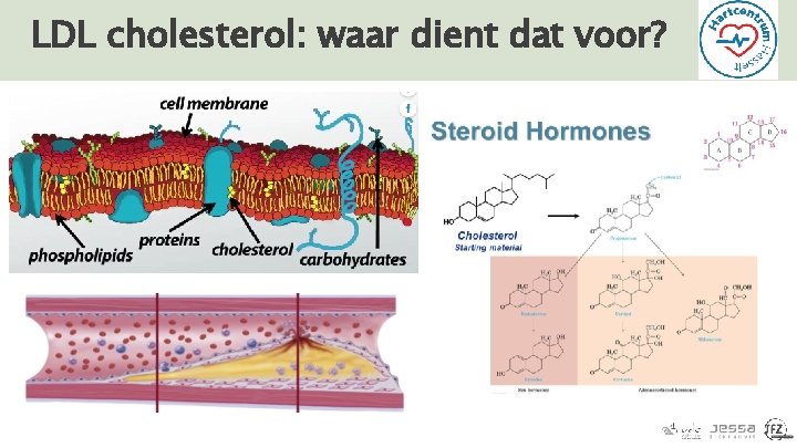 LDL cholesterol: waar dient dat voor? 