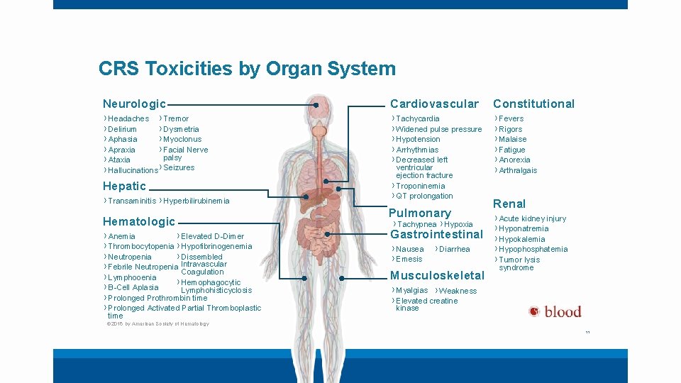 CRS Toxicities by Organ System Neurologic Cardiovascular Constitutional › Headaches › Tremor › Delirium