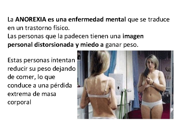 La ANOREXIA es una enfermedad mental que se traduce en un trastorno físico. Las