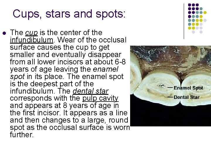 Cups, stars and spots: l The cup is the center of the infundibulum. Wear