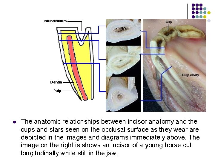 l The anatomic relationships between incisor anatomy and the cups and stars seen on