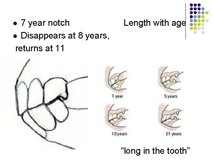 7 year notch l Disappears at 8 years, returns at 11 l Length with