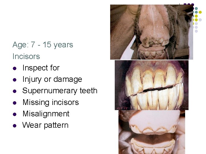 Age: 7 - 15 years Incisors l Inspect for l Injury or damage l