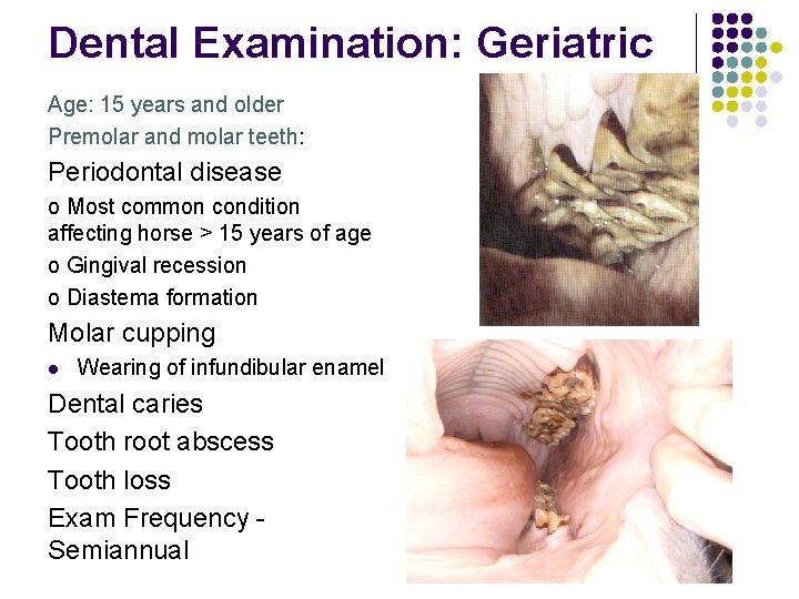 Dental Examination: Geriatric Age: 15 years and older Premolar and molar teeth: Periodontal disease