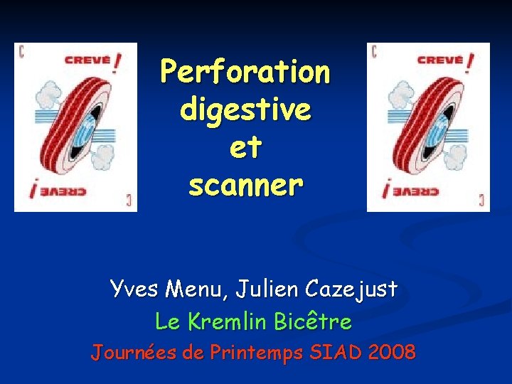 Perforation digestive et scanner Yves Menu, Julien Cazejust Le Kremlin Bicêtre Journées de Printemps