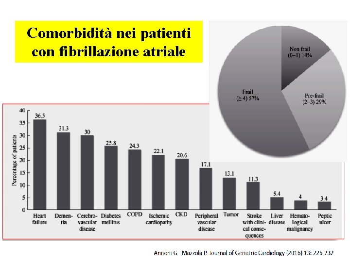 Comorbidità nei patienti con fibrillazione atriale 