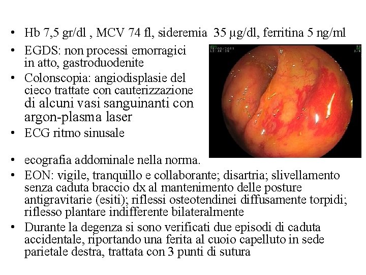  • Hb 7, 5 gr/dl , MCV 74 fl, sideremia 35 µg/dl, ferritina