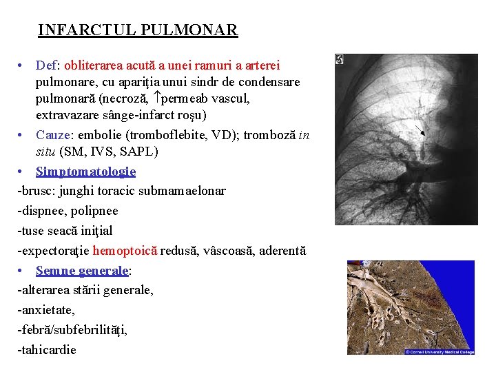 INFARCTUL PULMONAR • Def: obliterarea acută a unei ramuri a arterei pulmonare, cu apariţia