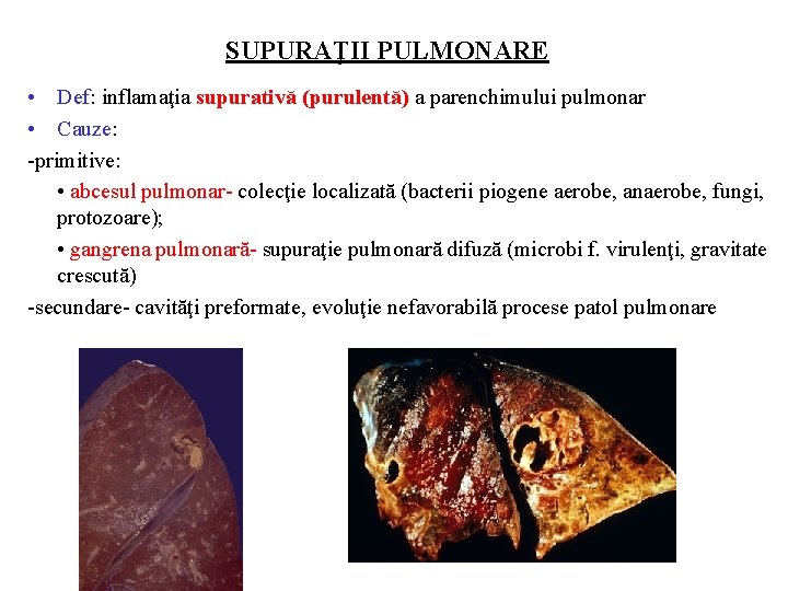 SUPURAŢII PULMONARE • Def: inflamaţia supurativă (purulentă) a parenchimului pulmonar • Cauze: -primitive: •