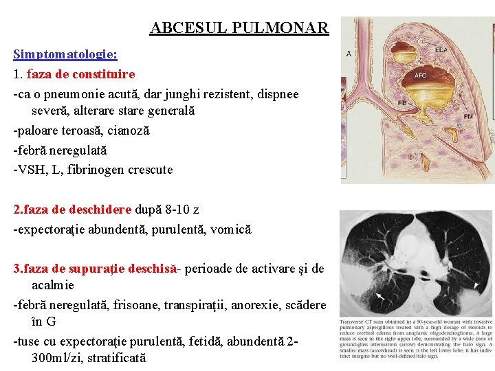 ABCESUL PULMONAR Simptomatologie: 1. faza de constituire -ca o pneumonie acută, dar junghi rezistent,