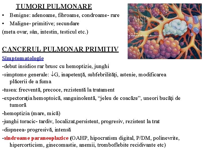 TUMORI PULMONARE • Benigne: adenoame, fibroame, condroame- rare • Maligne- primitive; secundare (meta ovar,