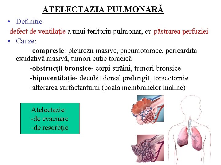 ATELECTAZIA PULMONARĂ • Definitie defect de ventilaţie a unui teritoriu pulmonar, cu păstrarea perfuziei