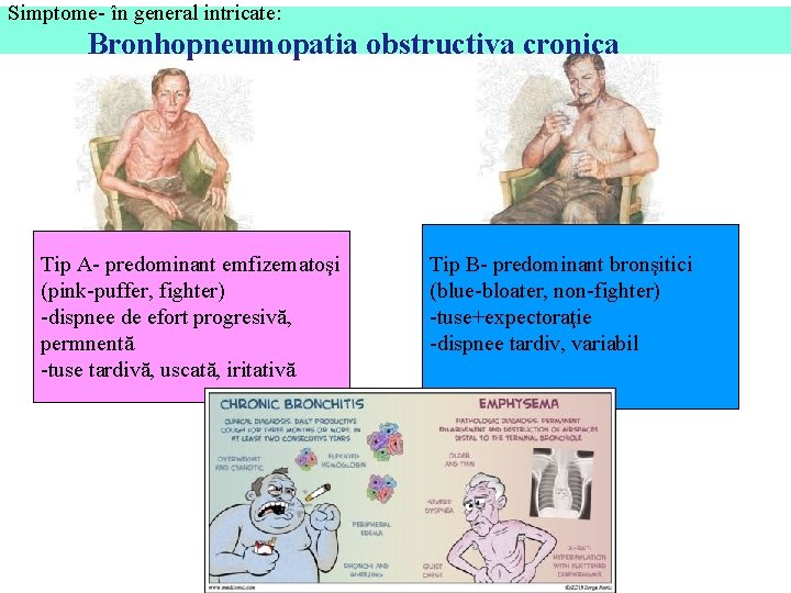 Simptome- în general intricate: Bronhopneumopatia obstructiva cronica Tip A- predominant emfizematoşi (pink-puffer, fighter) -dispnee