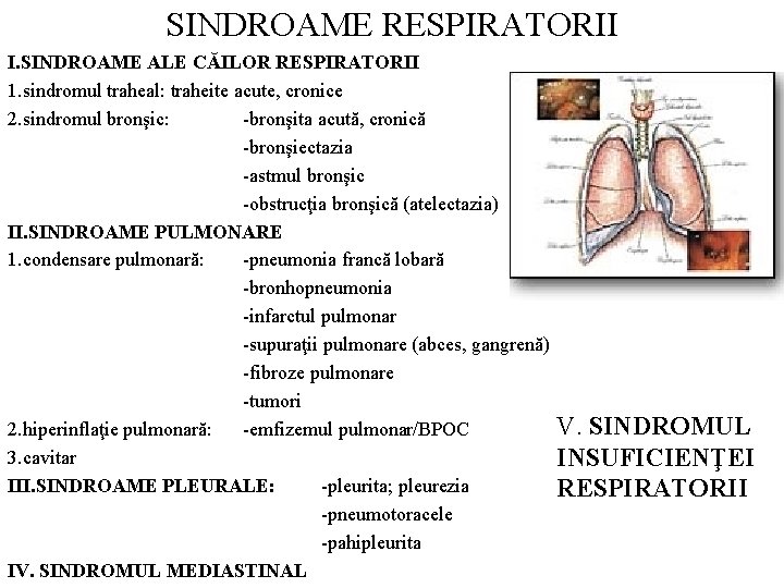 SINDROAME RESPIRATORII I. SINDROAME ALE CĂILOR RESPIRATORII 1. sindromul traheal: traheite acute, cronice 2.