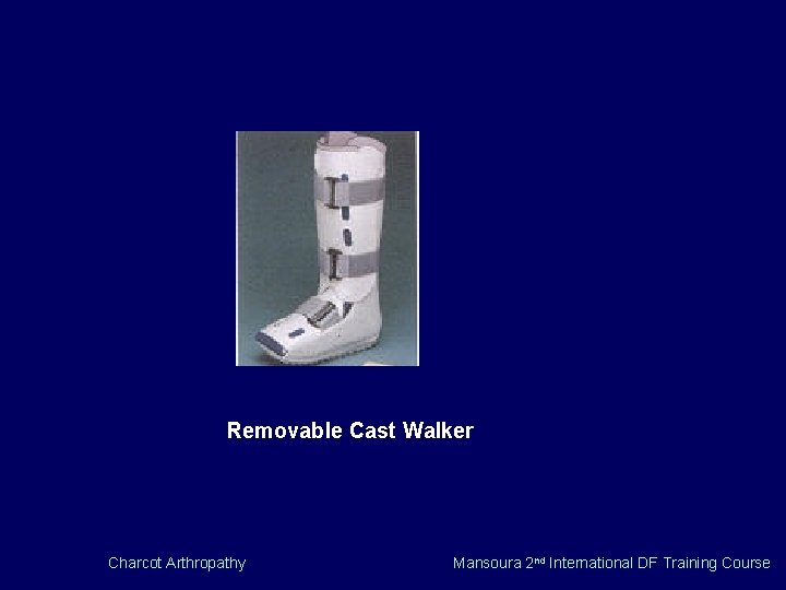 Removable Cast Walker Charcot Arthropathy Mansoura 2 nd International DF Training Course 