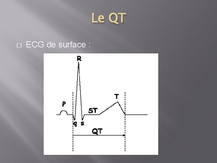 Le QT � ECG de surface : 