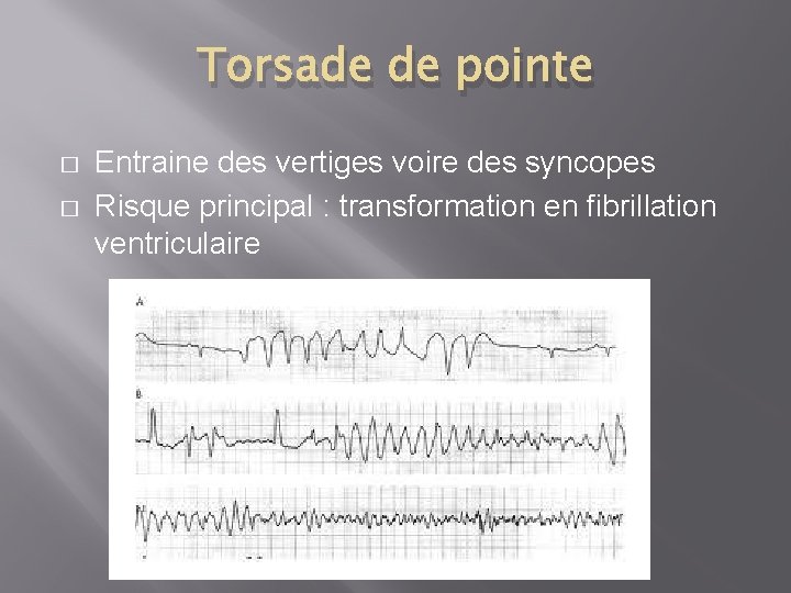 Torsade de pointe � � Entraine des vertiges voire des syncopes Risque principal :