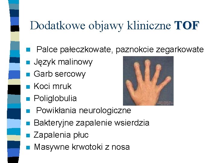 Dodatkowe objawy kliniczne TOF n n n n n Palce pałeczkowate, paznokcie zegarkowate Język