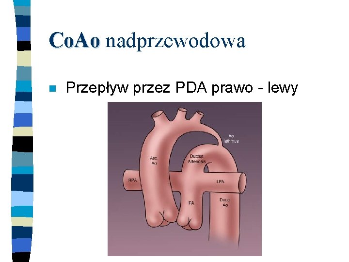 Co. Ao nadprzewodowa n Przepływ przez PDA prawo - lewy 