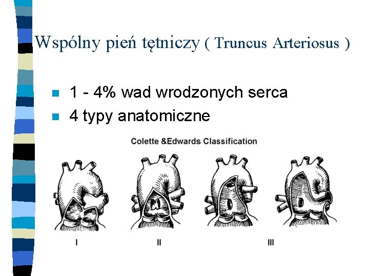 Wspólny pień tętniczy ( Truncus Arteriosus ) n n 1 - 4% wad wrodzonych