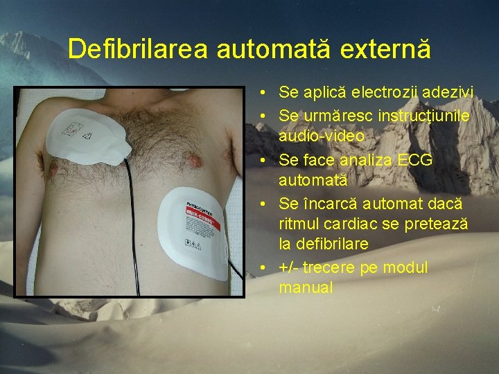 Defibrilarea automată externă • Se aplică electrozii adezivi • Se urmăresc instrucţiunile audio-video • Defibrilarea automată externă • Se aplică electrozii adezivi • Se urmăresc instrucţiunile audio-video •