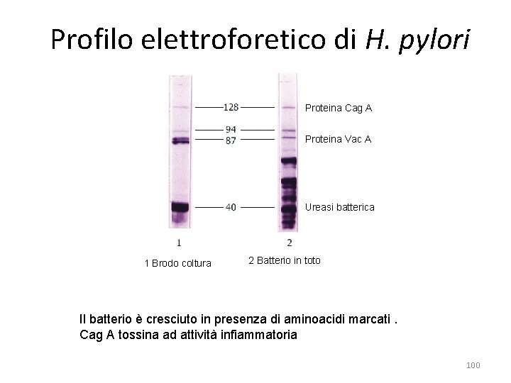Profilo elettroforetico di H. pylori Proteina Cag A Proteina Vac A Ureasi batterica 1 Profilo elettroforetico di H. pylori Proteina Cag A Proteina Vac A Ureasi batterica 1