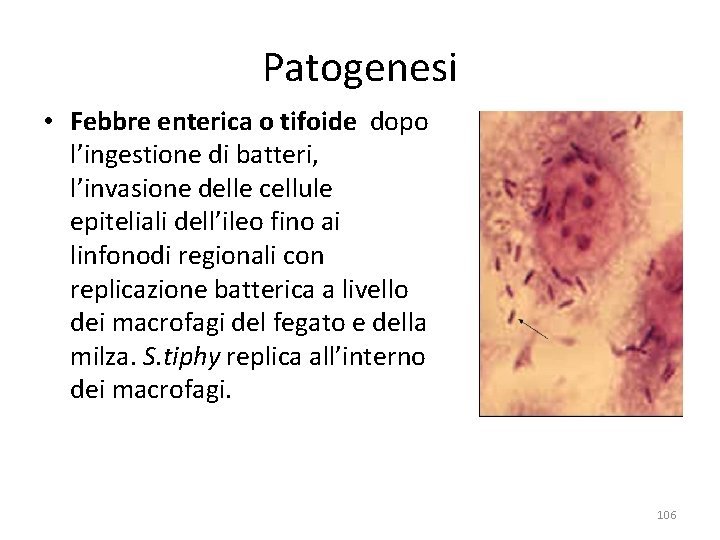 Patogenesi • Febbre enterica o tifoide dopo l’ingestione di batteri, l’invasione delle cellule epiteliali Patogenesi • Febbre enterica o tifoide dopo l’ingestione di batteri, l’invasione delle cellule epiteliali