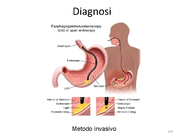 Diagnosi Metodo invasivo 108 Diagnosi Metodo invasivo 108