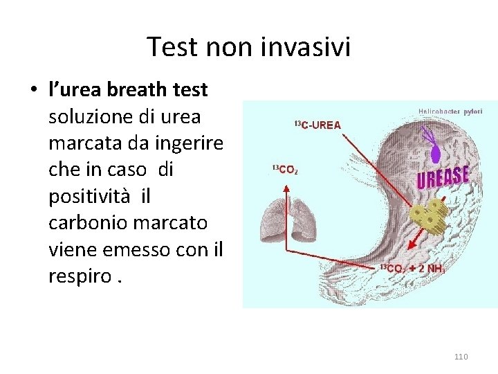 Test non invasivi • l’urea breath test soluzione di urea marcata da ingerire che Test non invasivi • l’urea breath test soluzione di urea marcata da ingerire che