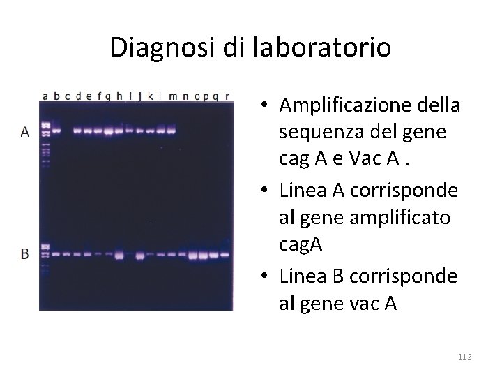 Diagnosi di laboratorio • Amplificazione della sequenza del gene cag A e Vac A. Diagnosi di laboratorio • Amplificazione della sequenza del gene cag A e Vac A.