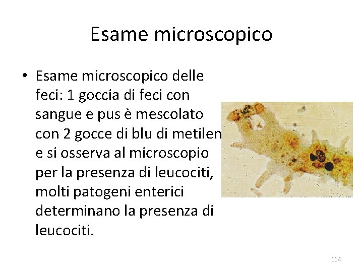 Esame microscopico • Esame microscopico delle feci: 1 goccia di feci con sangue e Esame microscopico • Esame microscopico delle feci: 1 goccia di feci con sangue e