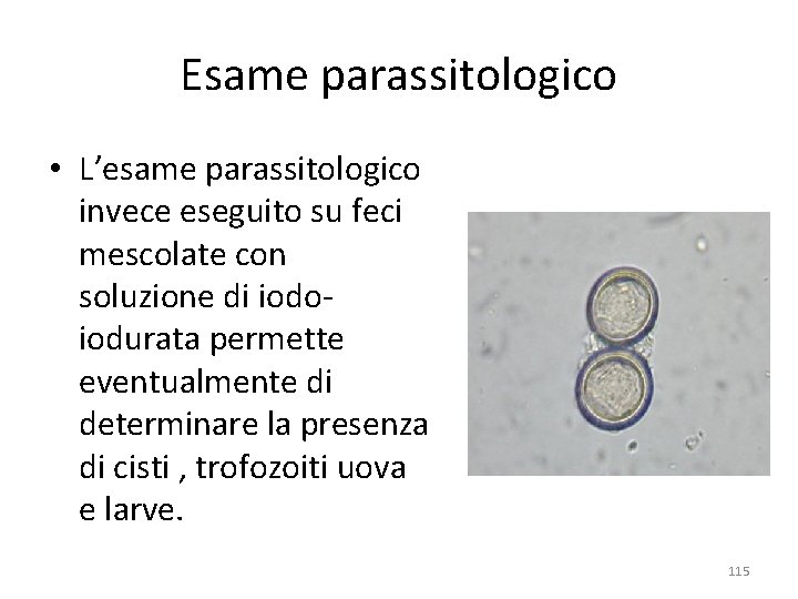 Esame parassitologico • L’esame parassitologico invece eseguito su feci mescolate con soluzione di iodoiodurata Esame parassitologico • L’esame parassitologico invece eseguito su feci mescolate con soluzione di iodoiodurata